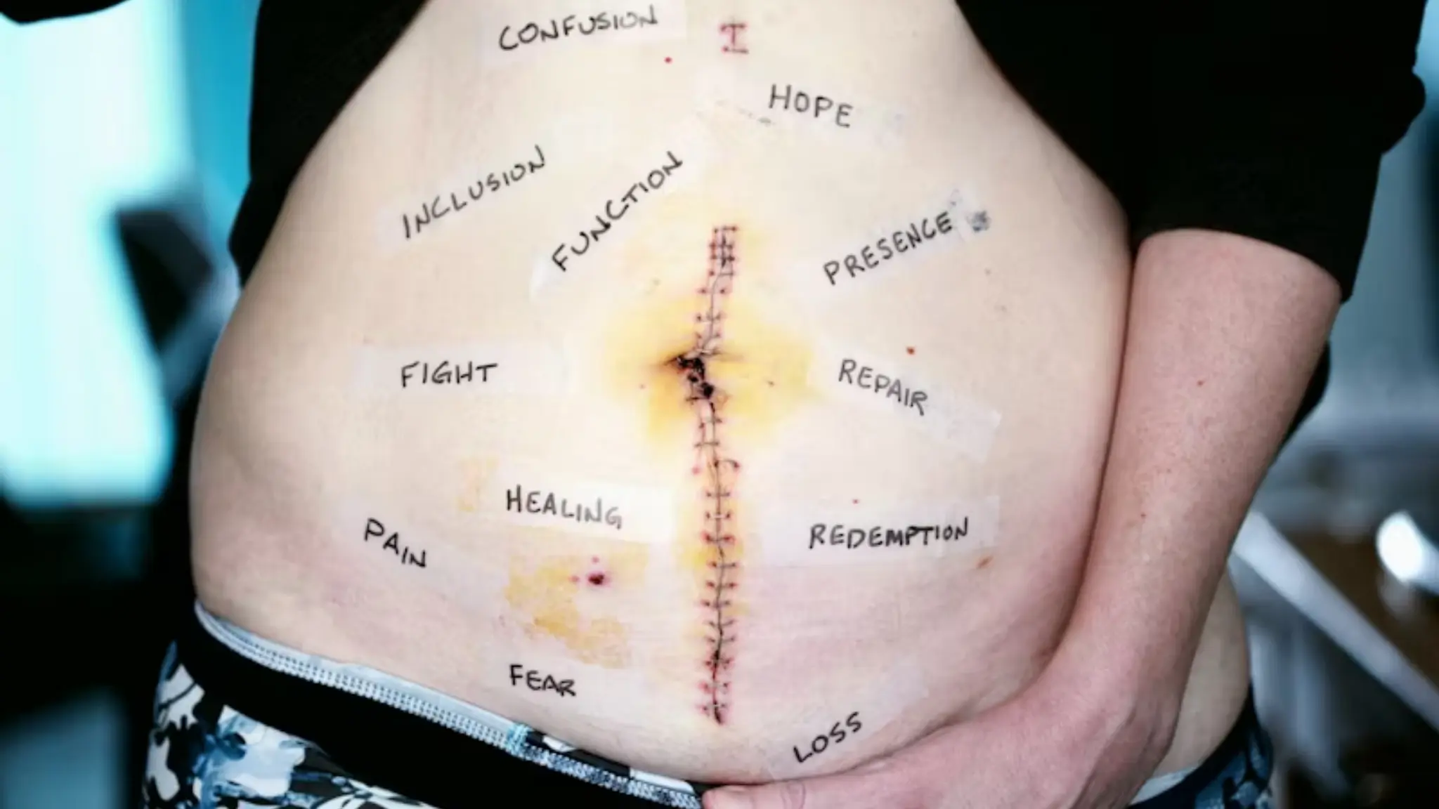 prayers for cancer healing